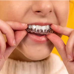 Girl putting Invisalign on her teeth